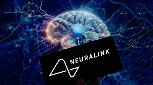 Second Patient set to receive Musk's Brain Chip Implant, Reports WSJ