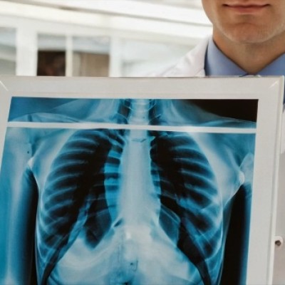 Russian Health Experts Warn of Rising Post-Covid Lung Fibrosis Cases