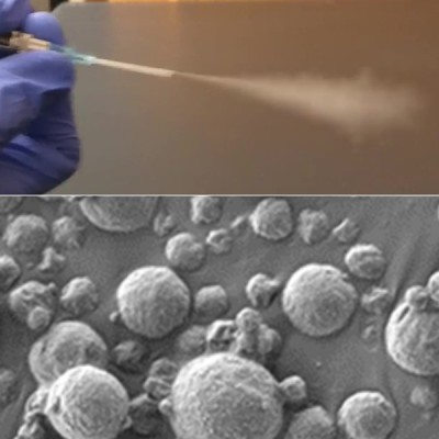 Early detection of lung cancer is possible with the aspiration sensor